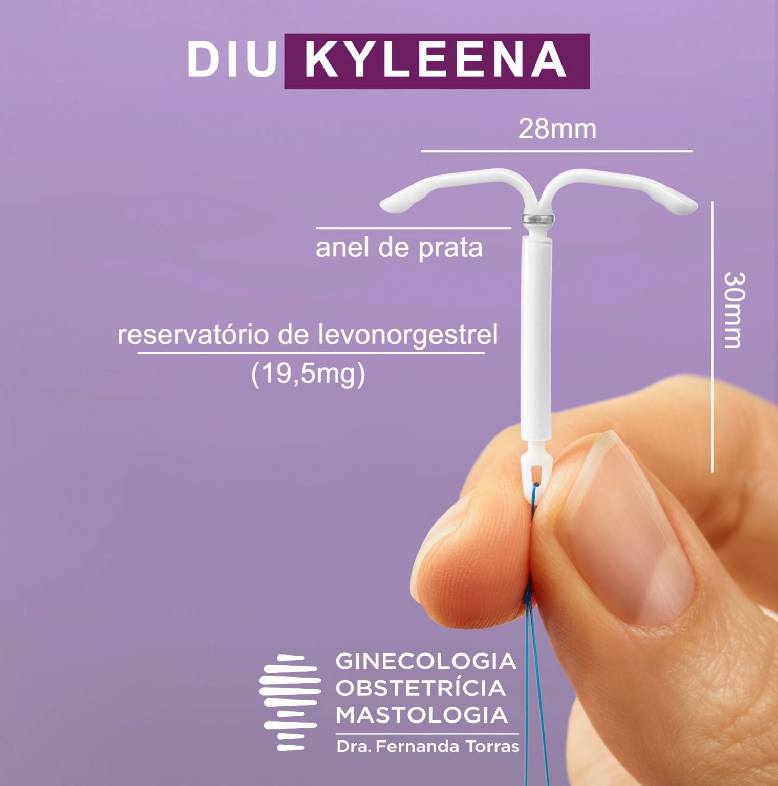 DIU Kyleena Colocar Em S o Paulo 11 2892 4401
