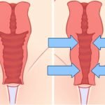 rejuvenescimento intimo antes e depois