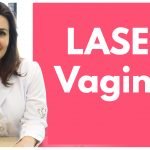laser vaginal