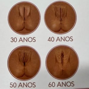bioestimulador antes e depois