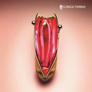 Mitos sobre a Ninfoplastia
