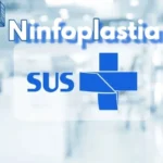 ninfoplastia sus