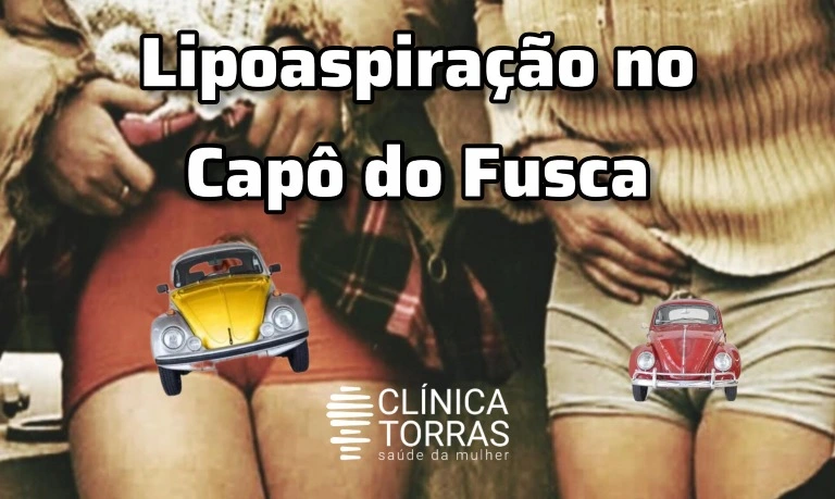 lipo-capo-fusca