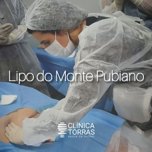 lipoaspiração pubiana