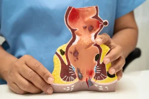 Vulva de Ozempic: o que é, por que acontece e como tratar com segurança
