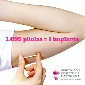 Implanon