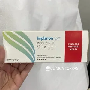 Qual o valor para colocar o Implanon?
