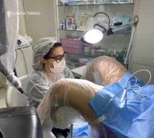 Realização da Labioplastia em Consultório (sem internação)