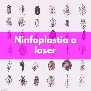 Não existe padrão de vulva!