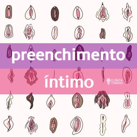Preenchimento Íntimo